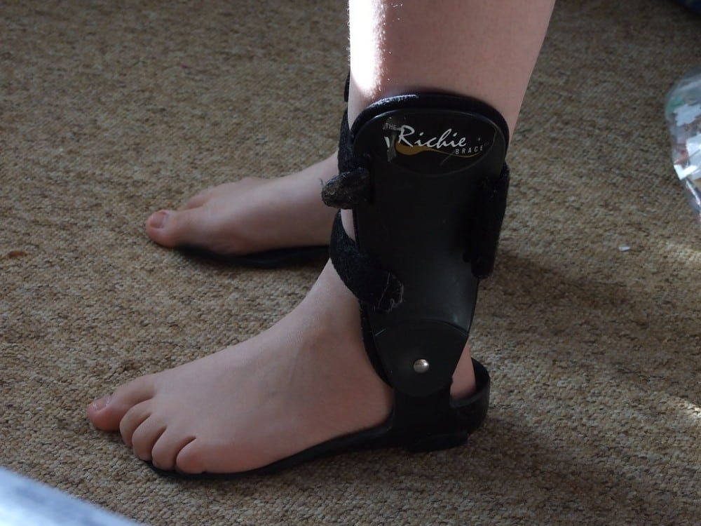 ankles